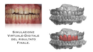 Dr Massimo Pedrinazzi - esempio di caso trattato